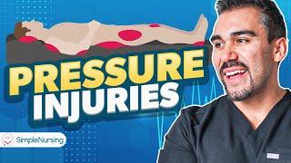 Pressure Injuries Ulcers Nursing  Patho Causes 6 Stages Braden Scale