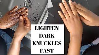 LIGHTEN DARK KNUCKLES FAST WITH THIS SUPER EFFECTIVE KNUCKLE SCRUB