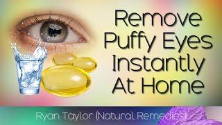How To Remove Puffy Eyes Instantly Natural Remedies
