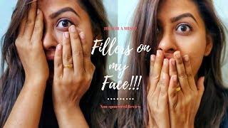 Tried Hyaluronic Acid Fillers on my Face  Indian Vlog Kosmoderma Experience