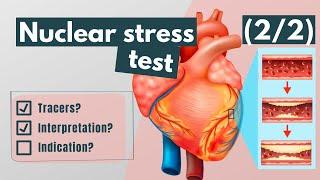 Nuclear stress test Tracers interpretation and indications 22