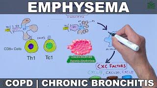 Emphysema  COPD