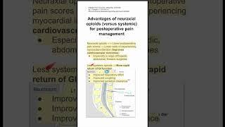 Advantages of neuraxial opioids versus systemic for postoperative pain management