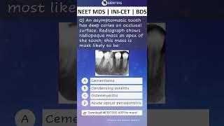 NEET MDS  INI-CET MDS  PSC  BDS - Most Important Questions  #neetmds2025 #mdsprep