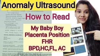 Anomaly Scan 20 weeks घर पर कैसे पड़े ।Anomaly Scan Baby Boy or Baby Girl How to Read level 2 report