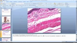 Medical School Pathology 2012 Session 052 GI-I.mov