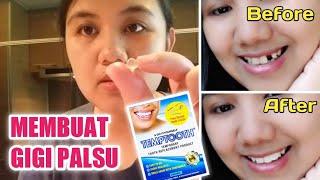 Membuat Gigi Palsu Dengan Produk Temptooth