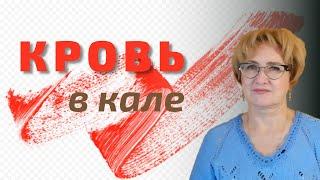 Кровь в кале