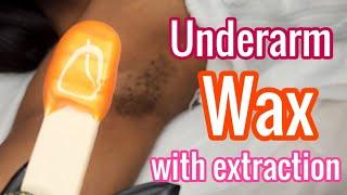 I Extracted This From Her Armpit #UnderarmWax #BodyWax
