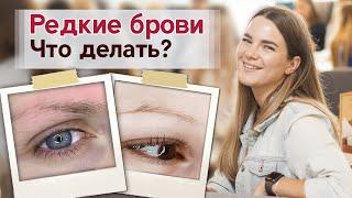 Перещипанные и редкие брови Что делать?  Как происходит перещипывание бровей?