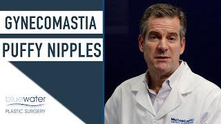 Are Puffy Nipples a Form of Gynecomastia?  Gynecomastia Surgery Raleigh