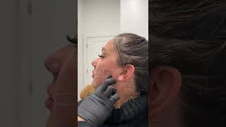 Masseter Botox 101 at SEV 