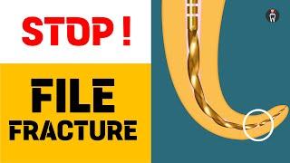 STOP FILE FRACTURE