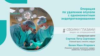 Удаление опухоли молочной железы + одномоментное эндопротезирование