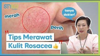 Tips & Trik Cara Menangani Rosacea Wajah Memerah Panas Perih Gatal  Stylo