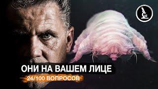 ЭТОТ ЛИЦЕВОЙ КЛЕЩ РЕАЛЬНО ЖИВЕТ НА ВАШЕМ ЛИЦЕ? DEMODEX  КЛЕЩ ЖЕЛЕЗНИЦА