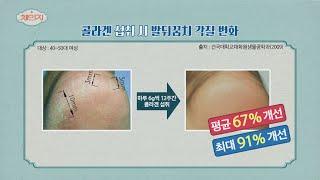 발뒤꿈치 각질을 잠재운 콜라겐의 놀라운 보습력.. 체인지change 70회  JTBC 201125 방송