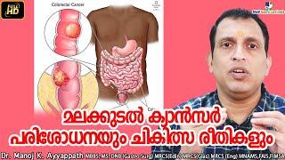 മലക്കുടൽ ക്യാൻസർ  rectal cancer  പരിശോധനയും ചികിത്സ രീതികളും  M&M Gastro Care India