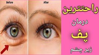 ماسک برای سیاهی وپف زیر چشم _ ساده ترین درمان پف زیرچشم ـ puffiness under eyes home remedy