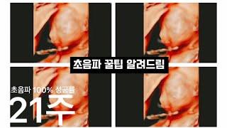 Hello baby 9. 21주 정밀초음파의 달인 초음파로 아기 얼굴 100% 볼 수 있는 꿀팁