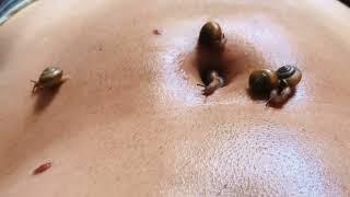 Belly button possessed by snails