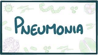 Pneumonia - causes symptoms diagnosis treatment pathology