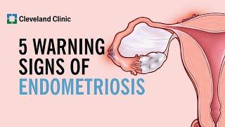 5 Warning Signs of Endometriosis