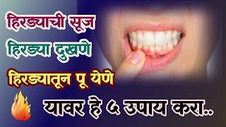 हिरड्यातून पू येणे हिरड्याची सूज हिरड्या दुखणे यावर हे ५ उपाय कराinflammation of gums