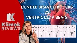 Ventricular Tachycardia VT vs Bundle Branch Block BBB