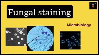 Stains Used in Mycology Lab  Fungal Stains  Microbiology  Hindi