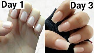 How to Grow really Long Nails Fast in 3 Days  100% Natural Home Remedies for Nail Growth.