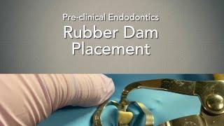 Rubber Dam Placement