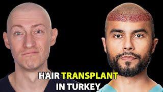 I Went To Turkey For A Hair Transplant  Hair Surgeon Reacts