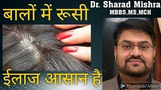 बालों में रूसी का इलाज आसान है सुनिए डॉ. शरद मिश्रा को