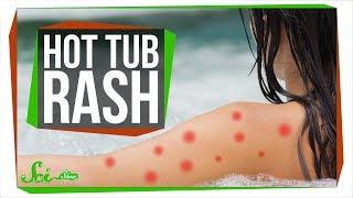 Can Hot Tubs Make You Sick?