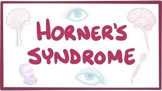 Horners syndrome - causes symptoms diagnosis treatment pathology