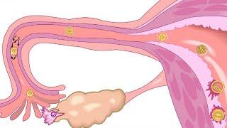 Ciclo menstrual - Dr.  Andrés Lemmo