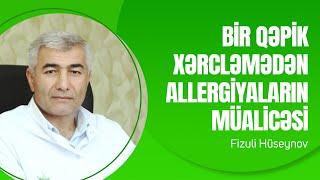 Bir qəpik xərcləmədən Allergiyayaların müalicəsi  Fizuli Hüseynov