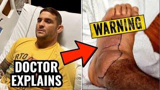 Dustin Poirier Shares Images of BAD Foot Infection - Doctor Explains