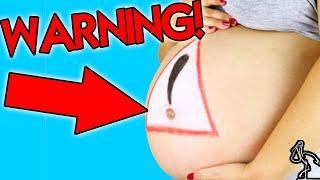 Midwife Advice  Hiccups in Pregnancy and Cord Around Babys Neck  What you NEED to know