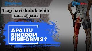 Apa Itu Sindrom Piriformis yang Viral di TikTok? Ini Gejala hingga Pengobatannya