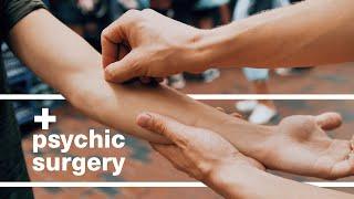 Psychic Surgery by Aaron Alexander Perform Invisible Surgery on Strangers