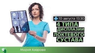 4 типа дисплазии локтевого сустава