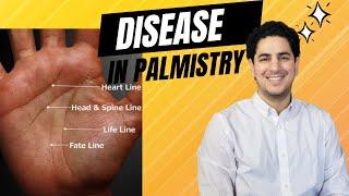  Signs of Disease on your Palm