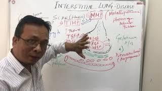 Interstitial lung diseasepathophysiology