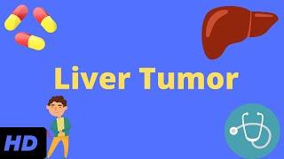 Liver Tumor Causes Signs and Symptoms Diagnosis and Treatment.