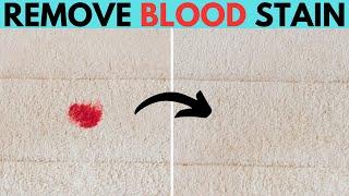 Best Way to Remove Dried Blood Stains from Carpet