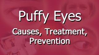 Puffy Eyes Causes Treatment Prevention