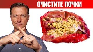 Очищение почек от оксалатов. Профилактика камней в почках 