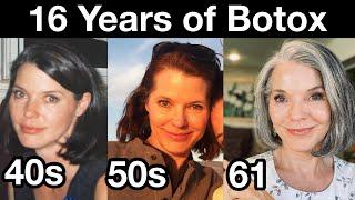 My 16 Year Botox Journey for Preventing Wrinkles  Anti-aging Strategies for 40s 50s and 60s